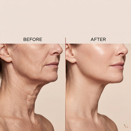 Ageless Neck Lift Cream Formula